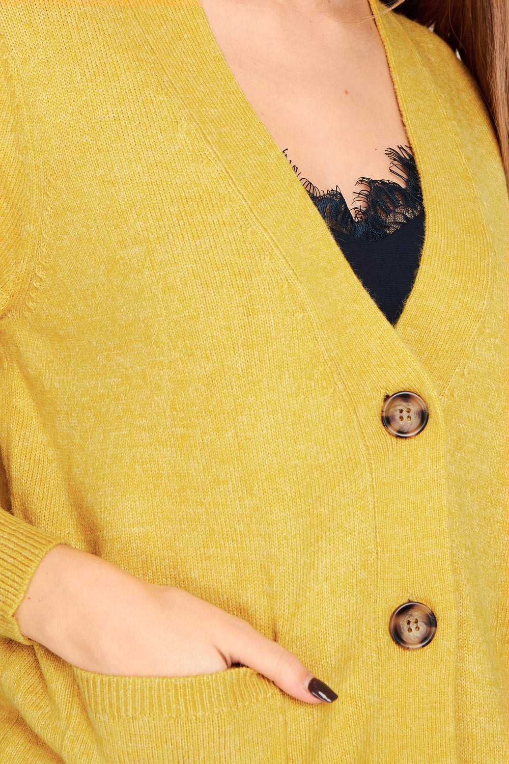 Cárdigan Botones Y Bolsillos Amarillo